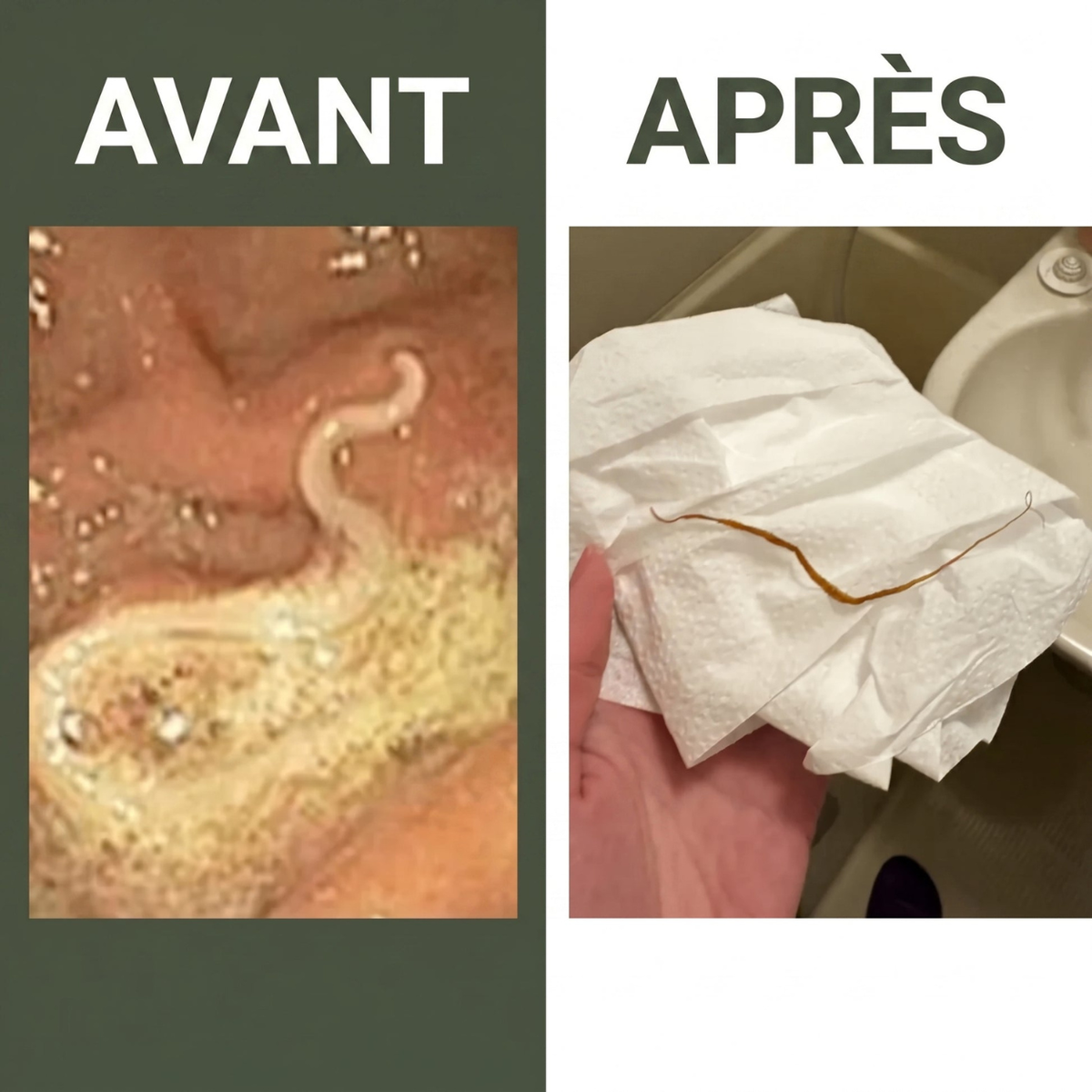 ORELINA PACK DETOX À L'HUILE DE RICIN